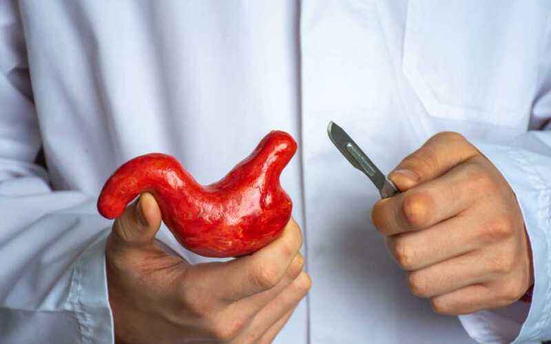 Como ver a lista de espera para cirurgia bariátrica pelo sus